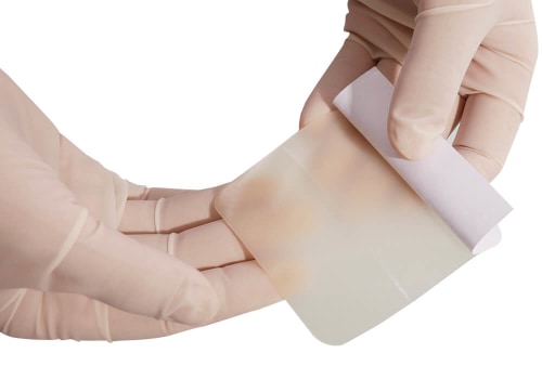 Hydrocolloid Dressing Examples That Help Promote Second-Degree Burn Healing